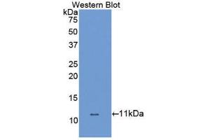 Western Blotting (WB) image for anti-Solute Carrier Family 6 (Neurotransmitter Transporter, Dopamine), Member 3 (SLC6A3) (AA 562-619) antibody (ABIN1867519) (SLC6A3 antibody  (AA 562-619))