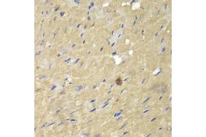 Immunohistochemistry of paraffin-embedded mouse heart using AKR7A2 antibody (ABIN5970569) at dilution of 1/100 (40x lens). (AKR7A2 antibody)