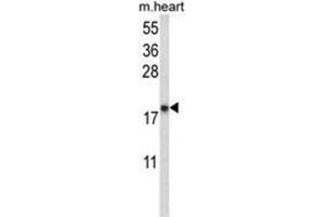 Western blot analysis of NPPA Antibody (N-term) in mouse heart tissue lysates (35ug/lane).