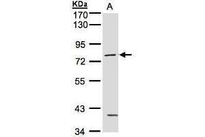 WB Image Sample(30 ug whole cell lysate) A:MOLT4 , 7. (PKC gamma antibody  (N-Term))