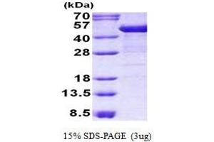 Image no. 1 for Keratin 19 (KRT19) protein (His tag) (ABIN1098759) (Cytokeratin 19 Protein (His tag))