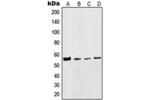 Western blot analysis of Cytokeratin 8 expression in HeLa (A), NIH3T3 (B), H9C2 (C), MCF7 (D) whole cell lysates.