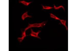 OR4C13 antibody  (C-Term)