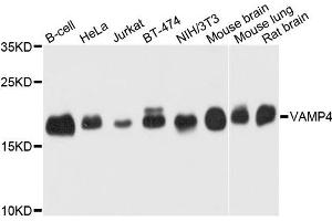 Western blot analysis of extract of various cells, using VAMP4 antibody. (VAMP4 antibody)