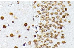 Immunohistochemistry of paraffin-embedded Rat brain using PRMT1 Polyclonal Antibody at dilution of 1:100 (40x lens). (PRMT1 antibody)