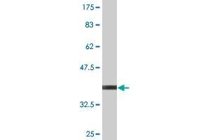 Western Blot detection against Immunogen (35. (UBE2B antibody  (AA 63-152))