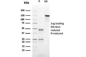 SDS-PAGE Analysis Purified CD21-Monospecific Mouse Monoclonal Antibody (CR2/2754). (CD21 antibody  (AA 142-240))