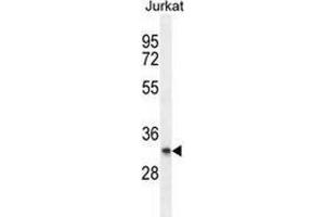 Western blot analysis in Jurkat cell line lysates (35ug/lane) using PRRG3 Antibody .