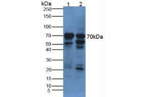 Figure. (alpha Fetoprotein antibody  (AA 31-171))