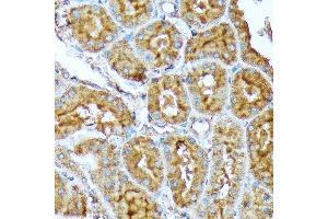 Immunohistochemistry of paraffin-embedded rat kidney using  Rabbit mAb (ABIN7265369) at dilution of 1:100 (40x lens). (Acetyl-CoA Carboxylase alpha antibody)