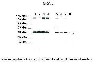 Lanes:   1: CD4 T cell lysate from WT mice, 2: CD4 T cell lysate from WT mice treated with anti-CD3/CD28, 3: CD4 T cell lysate from WT mice treated with FK506, 4: CD4 T cell lysate from WT mice treated with anti-CD3/CD28 and FK506, 5: CD4 T cell lysate from TRPV1 KO mice, 6: CD4 T cell lysate from TRPV1 KO mice treated with anti-CD3/CD28, 7: CD4 T cell lysate from TRPV1 KO mice treated with FK506, 8: CD4 T cell lysate from TRPV1 KO mice treated with anti-CD3/CD28 and FK506. (RNF128 antibody  (C-Term))