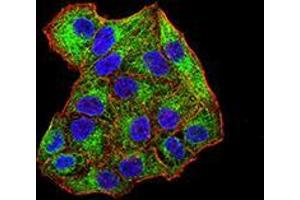 Immunofluorescence analysis of Hela cells using SYK mouse mAb (green). (SYK antibody  (AA 217-356))