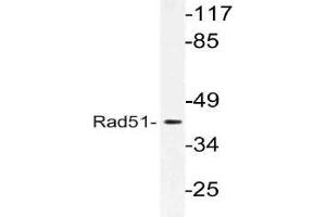Western blot (WB) analysis of Rad51 antibody in extracts from LOVO cells. (RAD51 antibody)