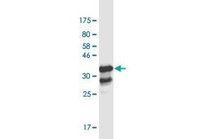Western Blot detection against Immunogen (37. (ZBTB7B antibody  (AA 433-537))