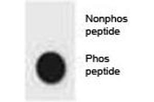 Dot blot analysis of phospho-CDKN2A antibody. (CDKN2A antibody  (pSer8))