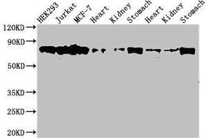 Western Blot Positive WB detected in: HEK293 whole cell lysate, Jurkat whole cell lysate, MCF-7 whole cell lysate, Rat heart tissue, Rat kideny tissue, Rat stomach tissue, Mouse heart tissue, Mouse kidney tissue, Mouse stomach tissue All lanes: PRKCH antibody at 3.