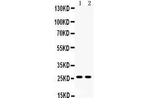 Anti-DUT antibody,  Western blotting All lanes: Anti DUT () at 0. (Deoxyuridine Triphosphatase (DUT) (AA 212-229), (C-Term) antibody)