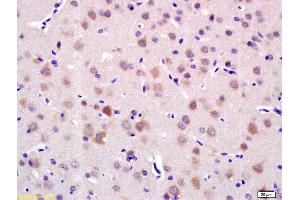 Formalin-fixed and paraffin embedded rat brain labeled with Anti-LRIG1 Polyclonal Antibody, Unconjugated (ABIN735263) at 1:200 followed by conjugation to the secondary antibody and DAB staining.