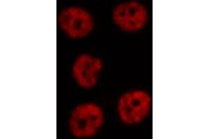 ABIN6274751 staining Hela cells by IF/ICC. (RPS19 antibody  (Internal Region))