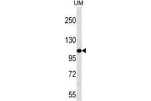 Western blot analysis in UM cell line lysates (35ug/lane) using Myosin-IIIb Antibody (C-term).