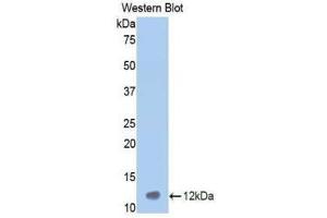Western Blotting (WB) image for anti-Vitronectin (VTN) (AA 400-468) antibody (ABIN1860949) (Vitronectin antibody  (AA 400-468))
