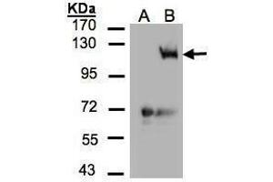 WB Image Western Blot analysis of PIK3CG expression in transfected 293T cell line by PIK3CG polyclonal antibody. (PIK3 gamma antibody  (C-Term))