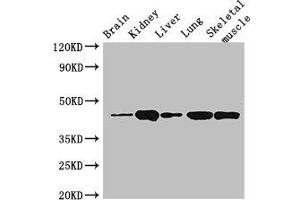 Western Blot Positive WB detected in: Mouse brain tissue, Mouse kidney tissue, Mouse liver tissue, Rat lung tissue, Rat skeletal muscle tissue All lanes: P2RX4 antibody at 3 μg/mL Secondary Goat polyclonal to rabbit IgG at 1/50000 dilution Predicted band size: 44, 46, 41 kDa Observed band size: 44 kDa (P2RX4 antibody  (AA 91-176))