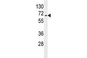 S6K2 antibody western blot analysis in Jurkat lysate (RPS6KB2 antibody)