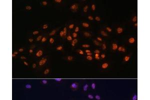 Immunofluorescence (IF) image for anti-Elongation Factor Tu GTP Binding Domain Containing 2 (EFTUD2) antibody (ABIN7262991)