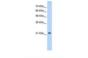 SLC25A14 antibody  (AA 51-100)