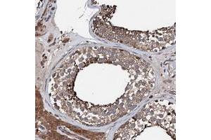Immunohistochemical staining of human testis with FGD4 polyclonal antibody  shows distinct cytoplasmic positivity in cells in seminiferus ducts.