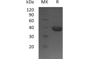 Western Blotting (WB) image for Cathepsin H (CTSH) (AA 22-333) protein (His tag) (ABIN7320712) (Cathepsin H Protein (CTSH) (AA 22-333) (His tag))