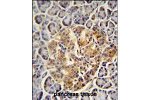 PRSS3 antibody immunohistochemistry analysis in formalin fixed and paraffin embedded human pancreas tissue followed by peroxidase conjugation of the secondary antibody and DAB staining. (PRSS3 antibody  (N-Term))