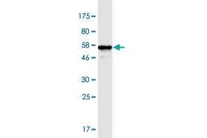 Western Blot detection against Immunogen (55. (ANP32B antibody  (AA 1-251))