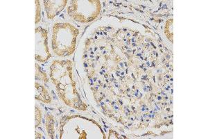 Immunohistochemistry (IHC) image for anti-Propionyl CoA Carboxylase beta Polypeptide (PCCB) antibody (ABIN1876603) (PCCB antibody)