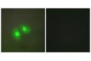 Immunofluorescence analysis of A549 cells, using TOP2A antibody. (Topoisomerase II alpha antibody  (N-Term))