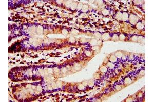 IHC image of ABIN7172046 diluted at 1:400 and staining in paraffin-embedded human small intestine tissue performed on a Leica BondTM system. (TST antibody  (AA 2-297))