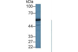 Western Blot; Sample: Human Jurkat cell lysate; Primary Ab: 1µg/ml Rabbit Anti-Human DARS Antibody Second Ab: 0. (DARS antibody  (AA 363-501))