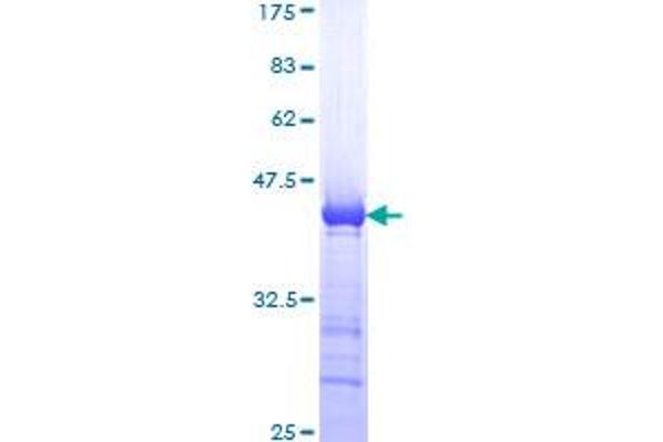 SMC1A Protein (AA 366-465) (GST tag)