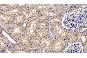 Detection of Ub in Human Kidney Tissue using Monoclonal Antibody to Ubiquitin (Ub) (Ubiquitin antibody  (AA 1-229))