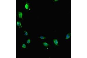 Immunofluorescent analysis of Hela cells using ABIN7172767 at dilution of 1:100 and Alexa Fluor 488-congugated AffiniPure Goat Anti-Rabbit IgG(H+L) (ATRX antibody  (AA 2161-2443))