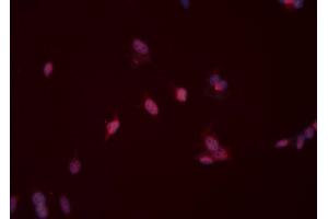 ABIN6276526 staining HeLa cells by ICC/IF. (MSH2 antibody  (C-Term))