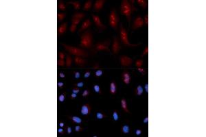 Immunofluorescence analysis of U2OS cell using PLCB1 antibody. (Phospholipase C beta 1 antibody  (AA 917-1216))