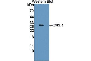 Detection of Recombinant PSMb6, Human using Polyclonal Antibody to Proteasome Subunit Beta Type 6 (PSMb6) (PSMB6 antibody  (AA 2-239))