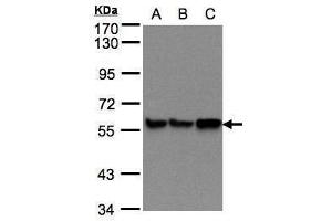 Western Blotting (WB) image for anti-Prolyl 4-Hydroxylase, beta Polypeptide (P4HB) antibody (ABIN2855054)