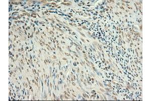 Image no. 7 for anti-Myc Proto-Oncogene protein (MYC) antibody (ABIN1497011) (c-MYC antibody)