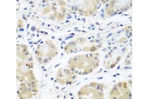 Immunohistochemistry of paraffin-embedded Human stomach using EIF3A Polyclonal Antibody at dilution of 1:100 (40x lens).
