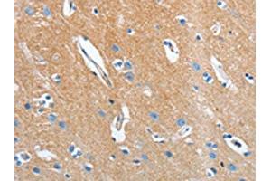 The image on the left is immunohistochemistry of paraffin-embedded Human brain tissue using ABIN7131012(SEPT9 Antibody) at dilution 1/15, on the right is treated with fusion protein. (Septin 9 antibody)