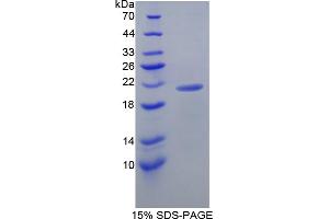 Image no. 1 for Lipocalin 8 (LCN8) (AA 27-176) protein (His tag) (ABIN6238310)
