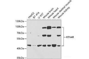Western blot analysis of extracts of various cell lines using RTN4R Polyclonal Antibody at dilution of 1:1000.